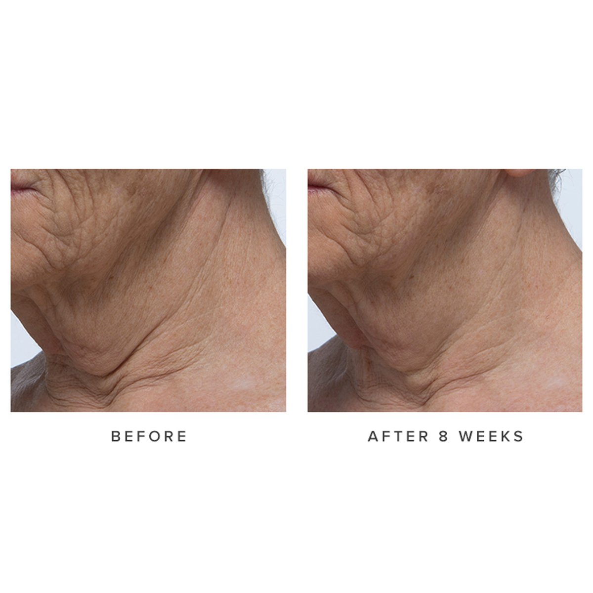 AgelessNeckCream-pdp-Clinicals-1200x1200_1ac36978-d2bc-4f20-9c47-2a95d6ed4fc2.jpg