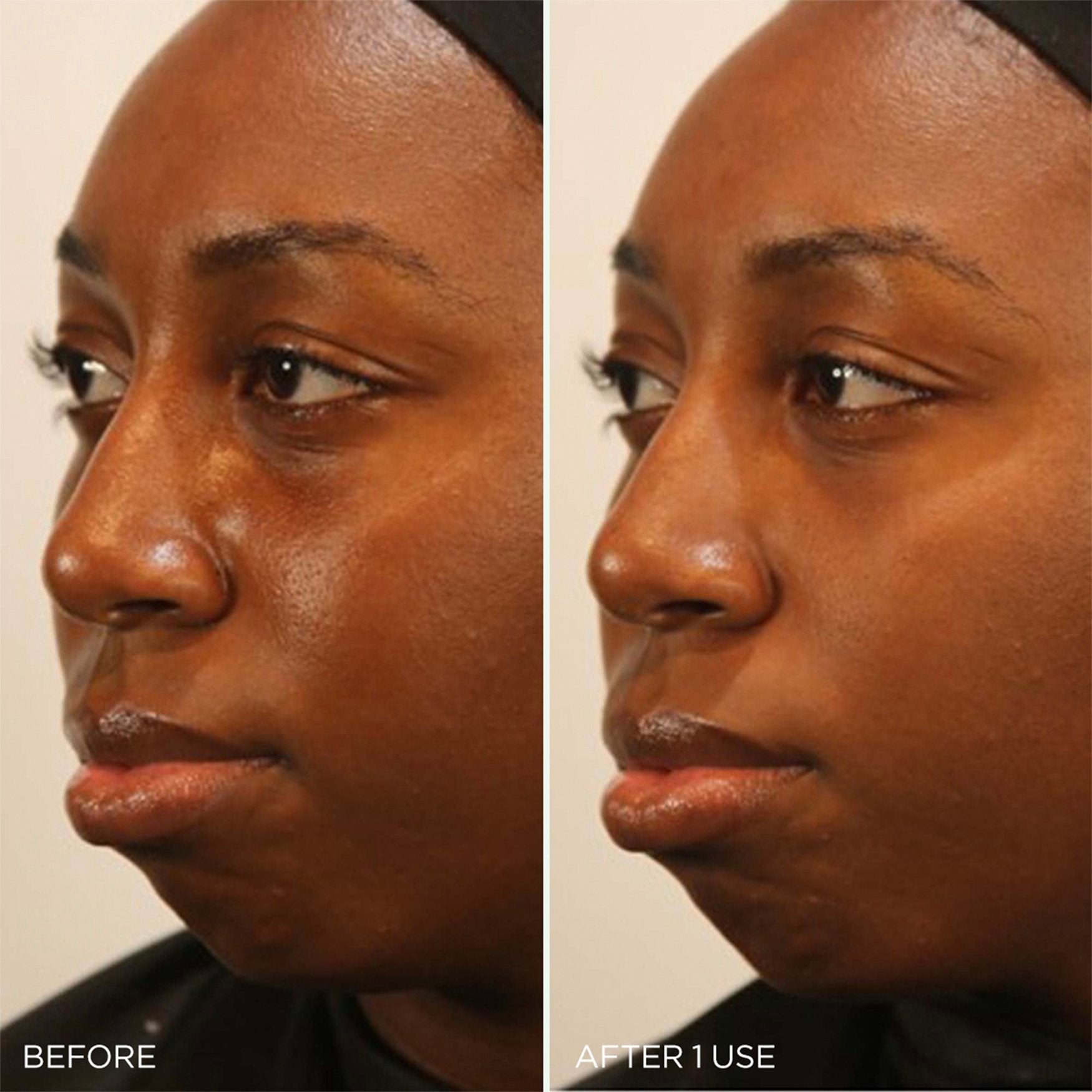 ClarifyingClayMask-pdp-BA-Clinicals-1200x1200_5960d29f-00bc-4627-9afb-8c8250111260.jpg