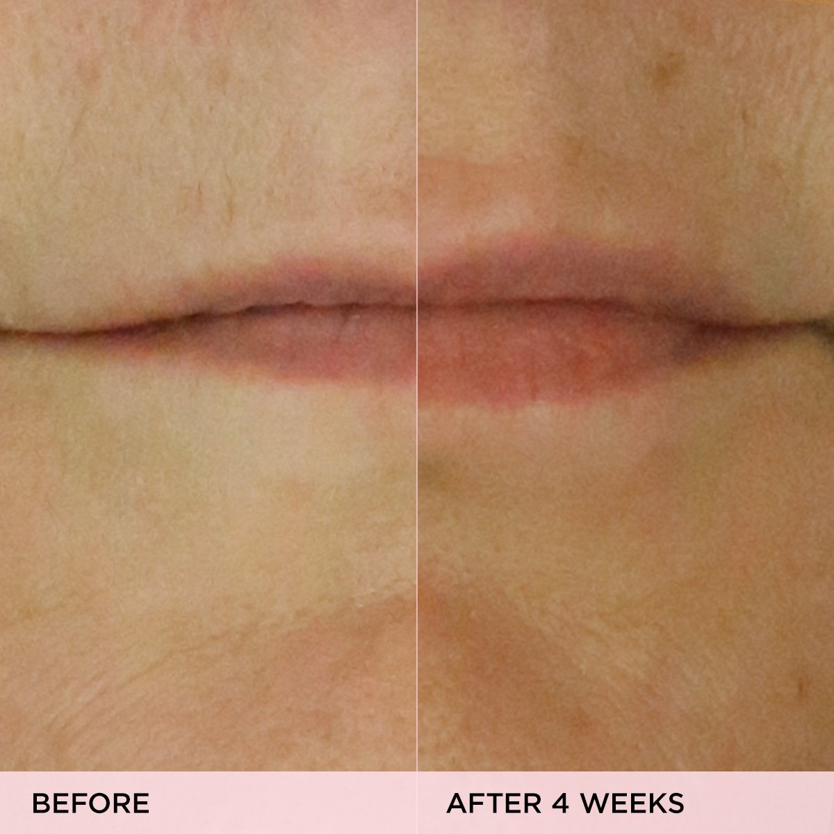 KissuLipTreatment-pdp-Clinicals-1200x1200_0d05f0b5-9735-4aaa-9079-6df29f10a867.jpg